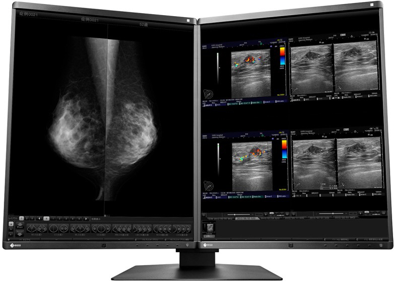 EIZO - RadiForce RX560 EIZO - RadiForce RX560